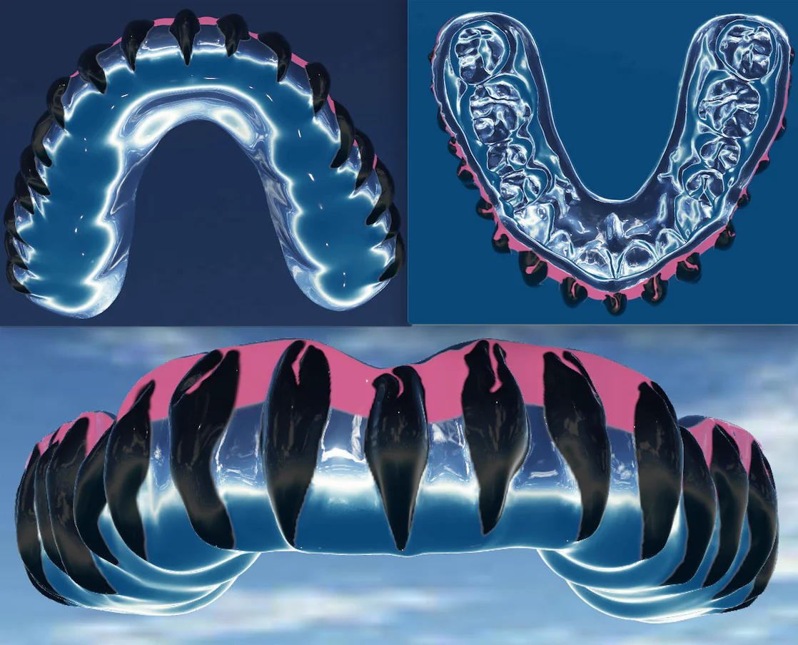Featured image for “Having Fun with Mouthguards”